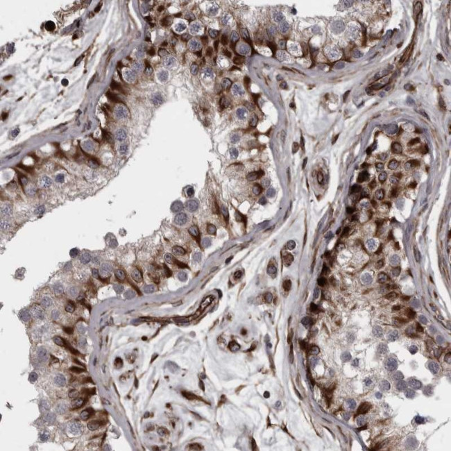 C17orf70 Antibody in Immunohistochemistry (Paraffin) (IHC (P))