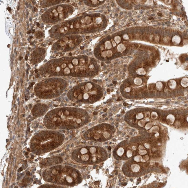 ZNF649 Antibody in Immunohistochemistry (Paraffin) (IHC (P))