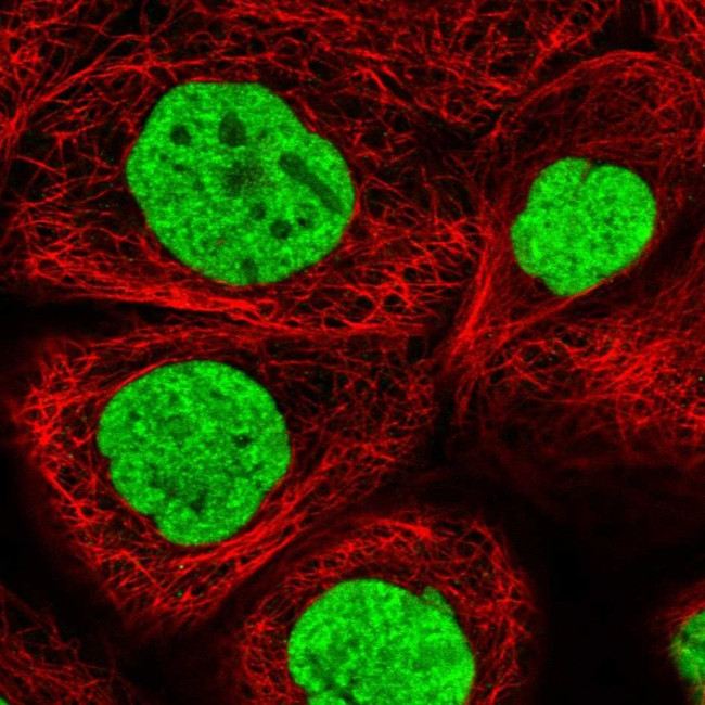 ALPK3 Antibody in Immunocytochemistry (ICC/IF)