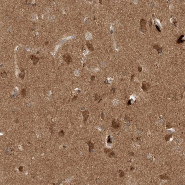 PITPNC1 Antibody in Immunohistochemistry (Paraffin) (IHC (P))