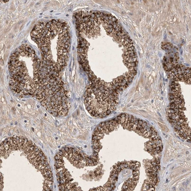 FAM221B Antibody in Immunohistochemistry (Paraffin) (IHC (P))