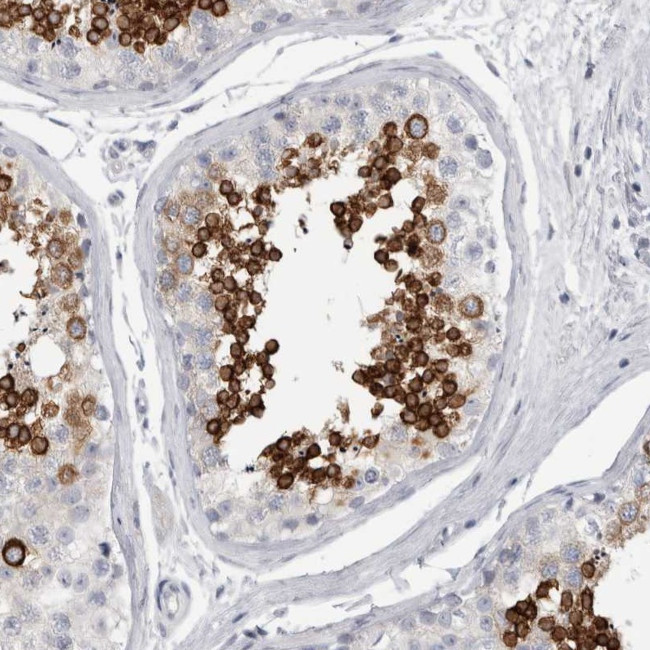 ADAM2 Antibody in Immunohistochemistry (Paraffin) (IHC (P))