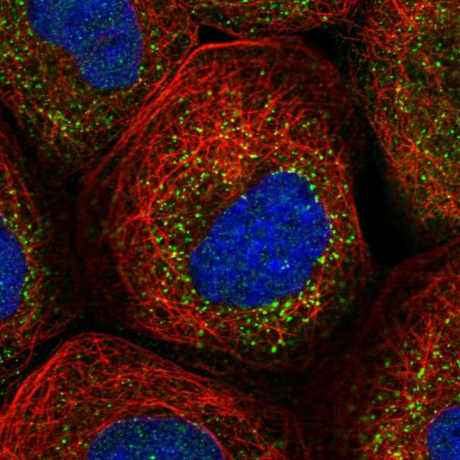 RABGGTB Antibody in Immunocytochemistry (ICC/IF)