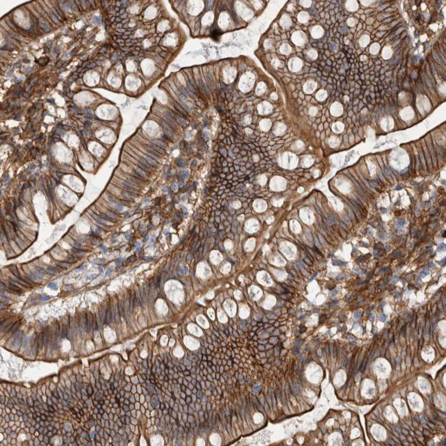 AHNAK Antibody in Immunohistochemistry (Paraffin) (IHC (P))