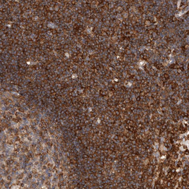 CCDC88B Antibody in Immunohistochemistry (Paraffin) (IHC (P))