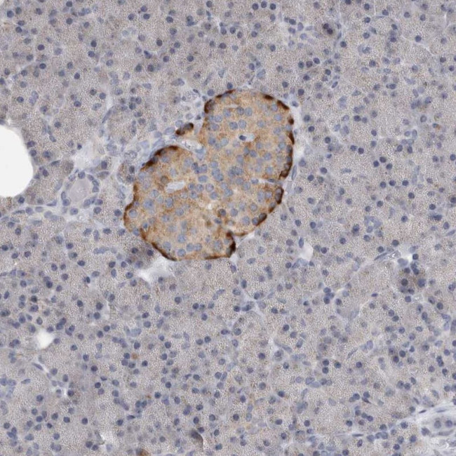 PTPRN2 Antibody in Immunohistochemistry (Paraffin) (IHC (P))