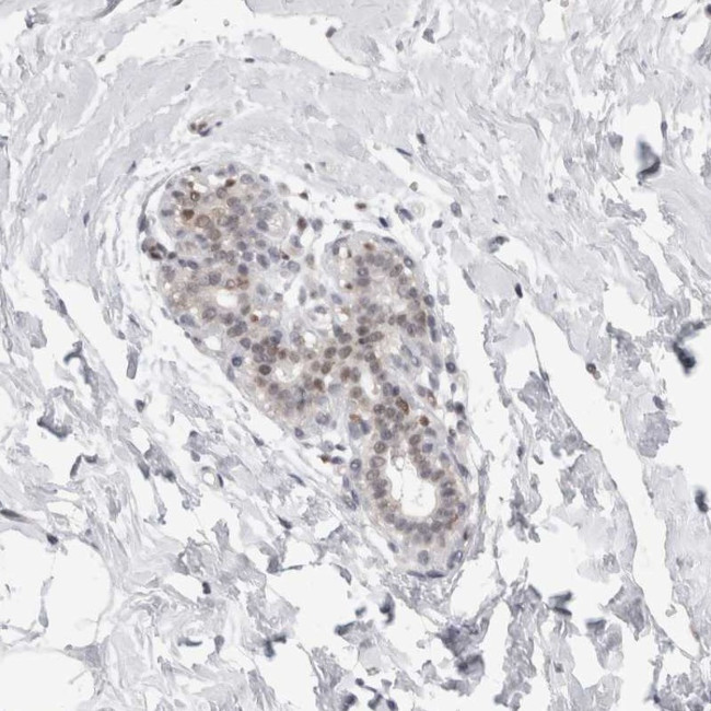 ERRF Antibody in Immunohistochemistry (Paraffin) (IHC (P))