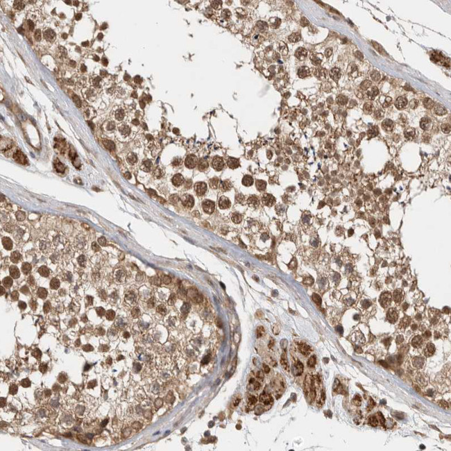 CCDC132 Antibody in Immunohistochemistry (IHC)