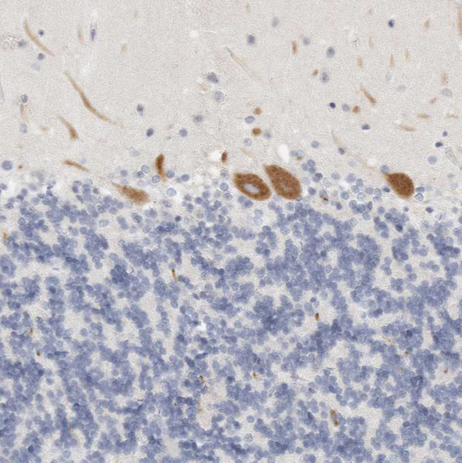 FGL2 Antibody in Immunohistochemistry (Paraffin) (IHC (P))