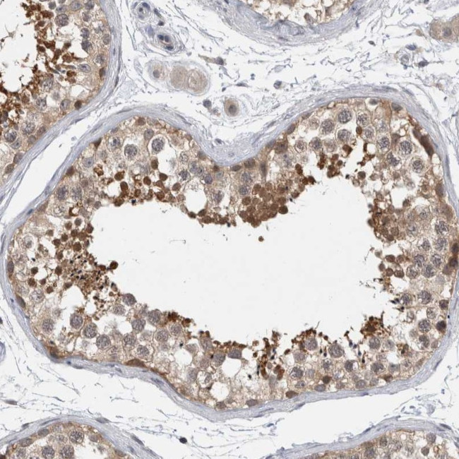 AASDHPPT Antibody in Immunohistochemistry (Paraffin) (IHC (P))