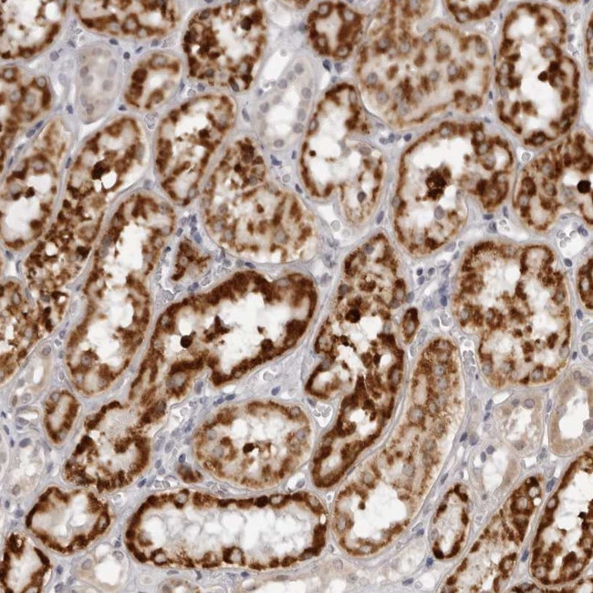 SUGCT Antibody in Immunohistochemistry (Paraffin) (IHC (P))