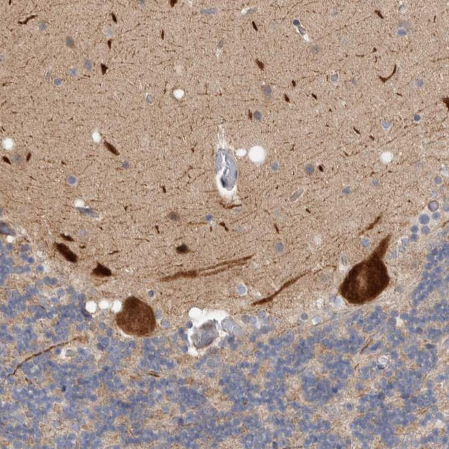 ZNF804B Antibody in Immunohistochemistry (Paraffin) (IHC (P))