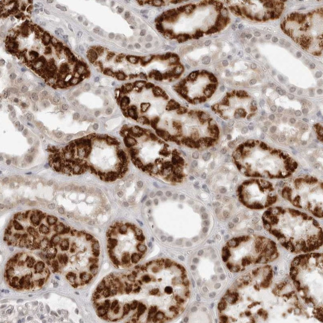 SUGCT Antibody in Immunohistochemistry (Paraffin) (IHC (P))
