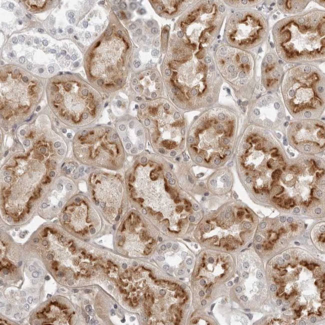 SUGCT Antibody in Immunohistochemistry (Paraffin) (IHC (P))