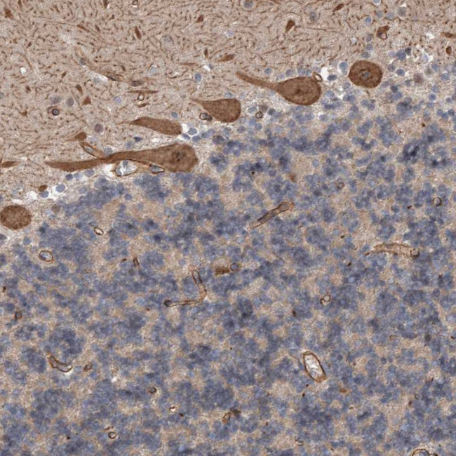 GIMAP6 Antibody in Immunohistochemistry (IHC)