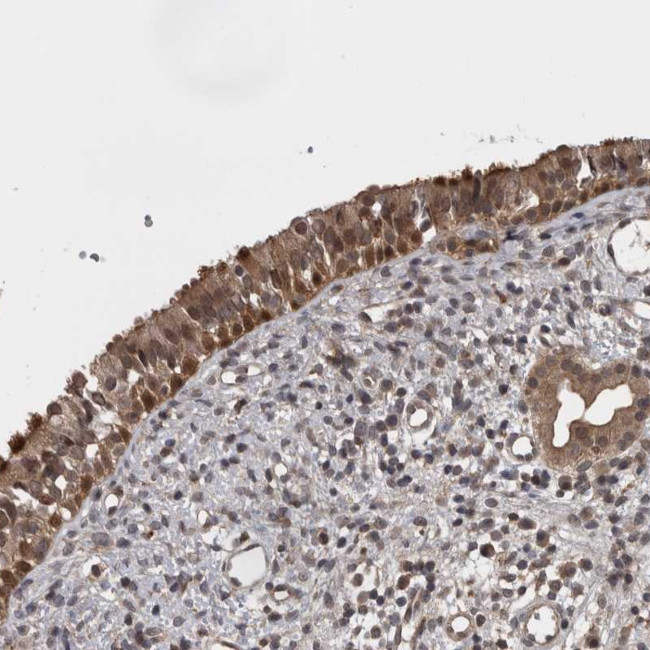 AOAH Antibody in Immunohistochemistry (Paraffin) (IHC (P))