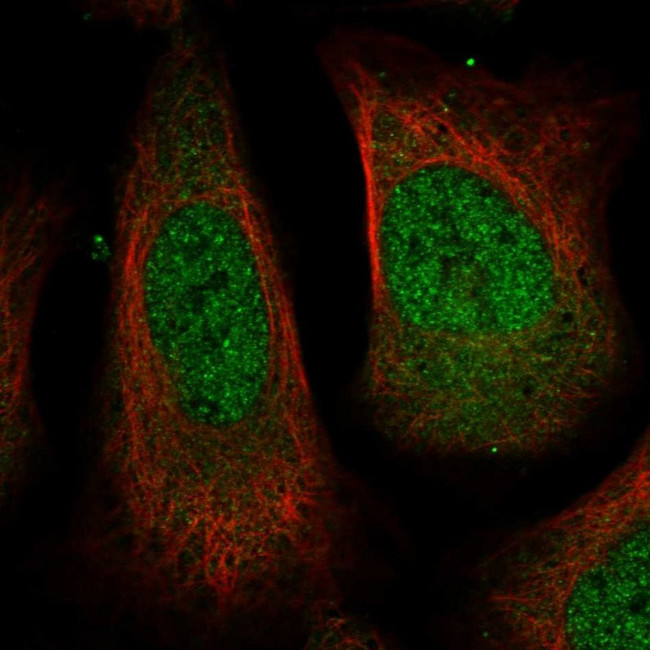 USP24 Antibody in Immunocytochemistry (ICC/IF)