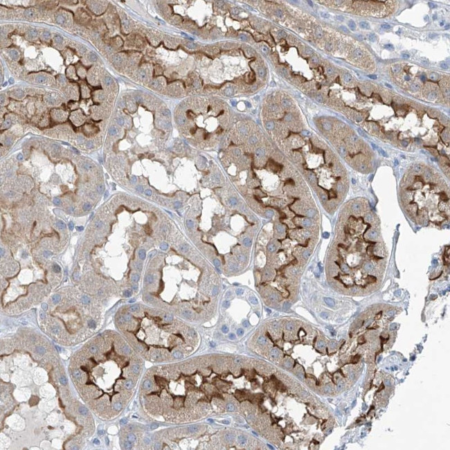 TNN Antibody in Immunohistochemistry (Paraffin) (IHC (P))