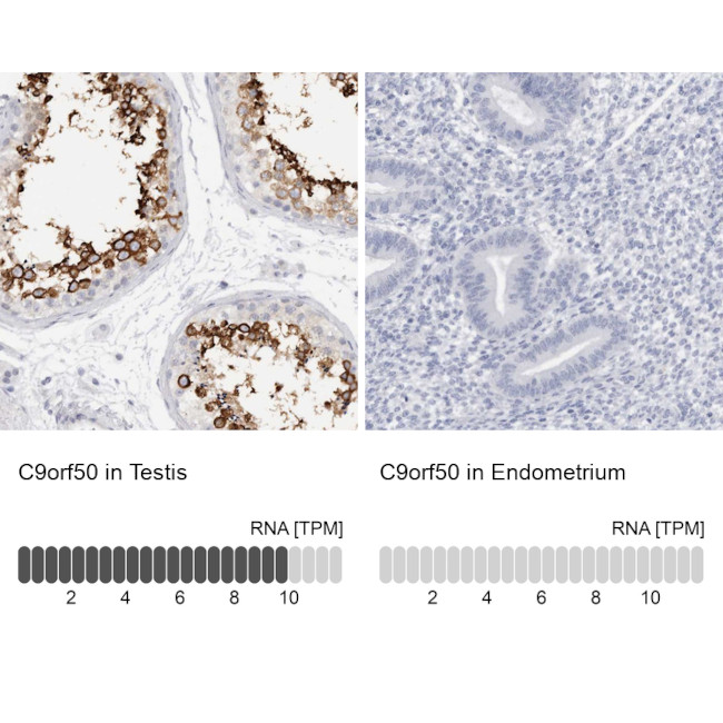 C9orf50 Antibody in Immunohistochemistry (IHC)