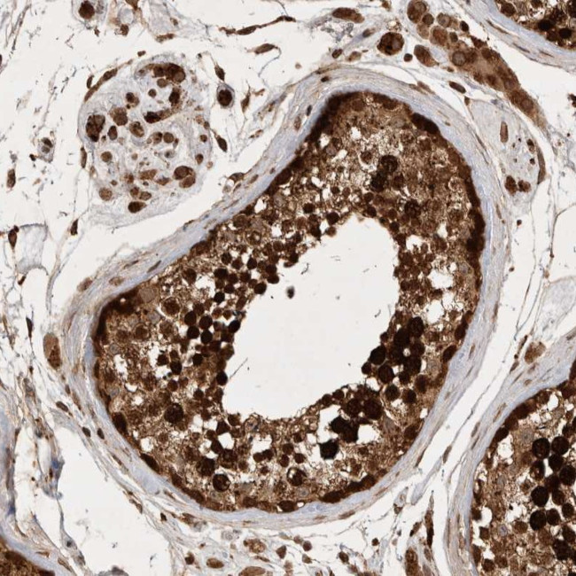 FAM221A Antibody in Immunohistochemistry (Paraffin) (IHC (P))