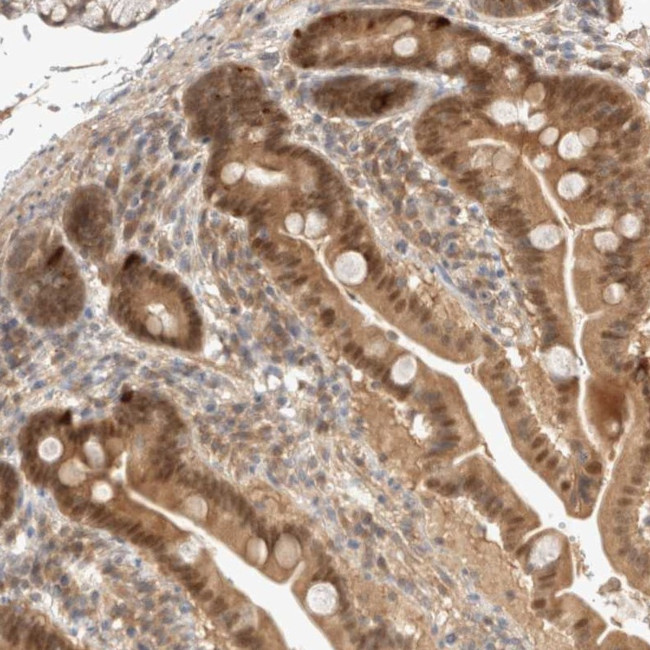 C9orf41 Antibody in Immunohistochemistry (Paraffin) (IHC (P))