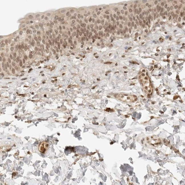 POLH Antibody in Immunohistochemistry (IHC)