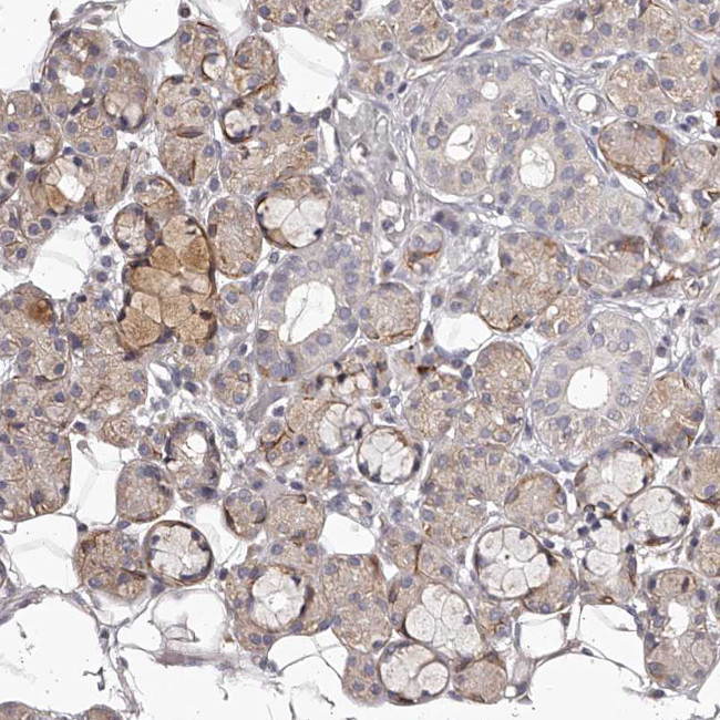 TNN Antibody in Immunohistochemistry (IHC)
