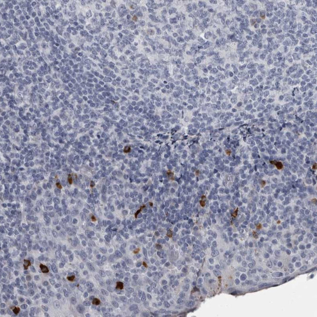 SLC25A39 Antibody in Immunohistochemistry (Paraffin) (IHC (P))