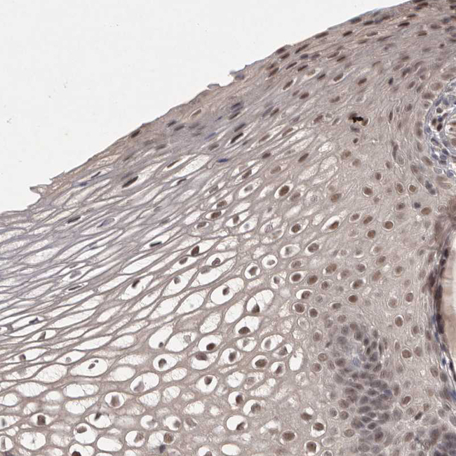 HUS1 Antibody in Immunohistochemistry (Paraffin) (IHC (P))