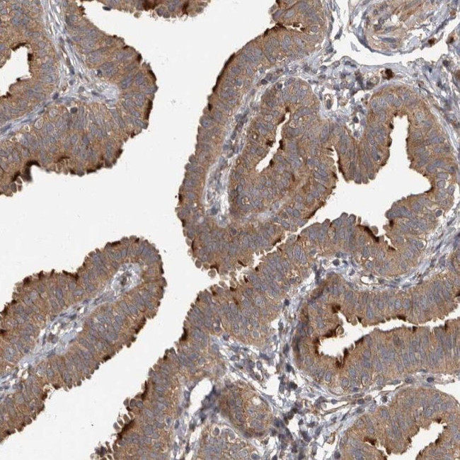 IQCK Antibody in Immunohistochemistry (IHC)