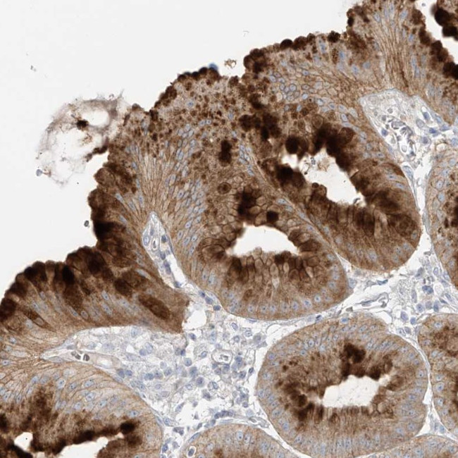 DGKQ Antibody in Immunohistochemistry (Paraffin) (IHC (P))