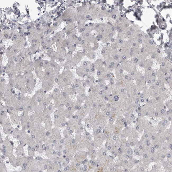 PRRX2 Antibody in Immunohistochemistry (Paraffin) (IHC (P))