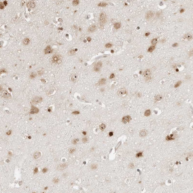 FKBP14 Antibody in Immunohistochemistry (Paraffin) (IHC (P))
