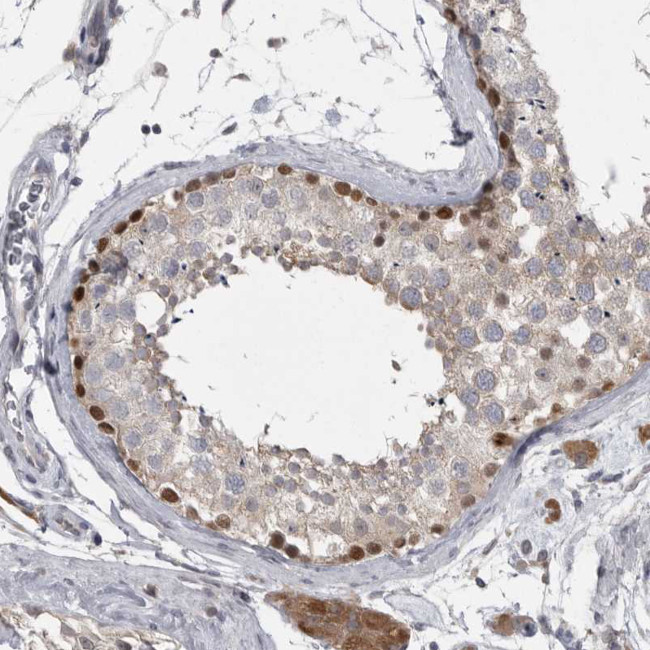 PHF13 Antibody in Immunohistochemistry (Paraffin) (IHC (P))
