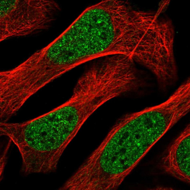 ZNF613 Antibody in Immunocytochemistry (ICC/IF)