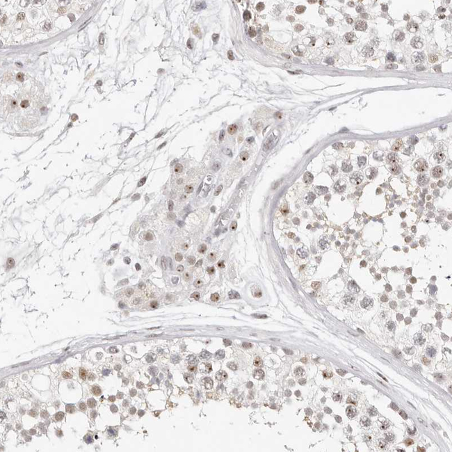LARP7 Antibody in Immunohistochemistry (Paraffin) (IHC (P))