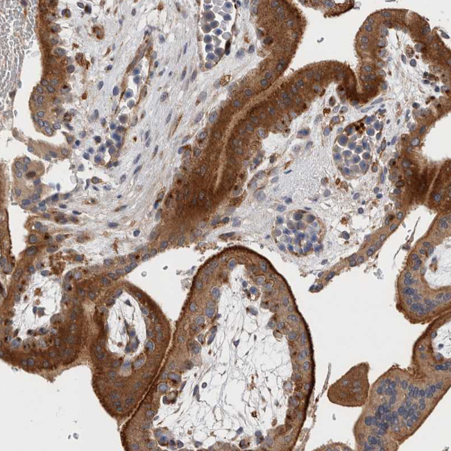 BNIP2 Antibody in Immunohistochemistry (Paraffin) (IHC (P))