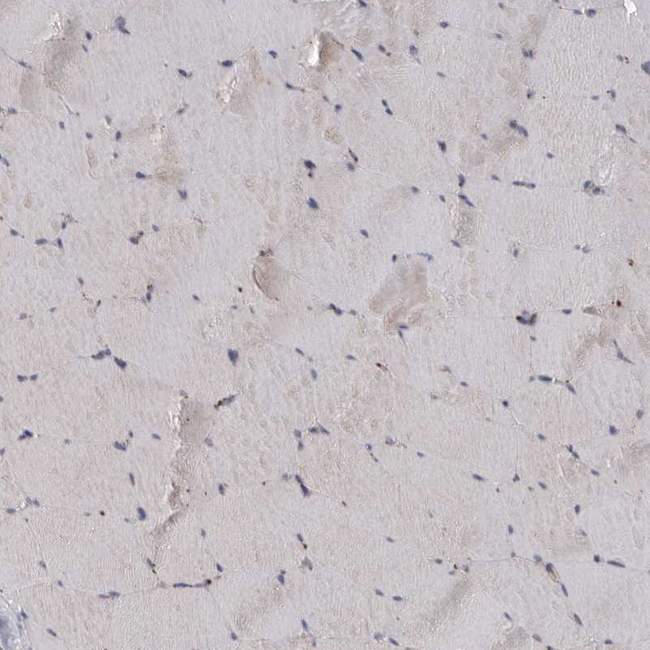 LAMTOR3 Antibody in Immunohistochemistry (Paraffin) (IHC (P))