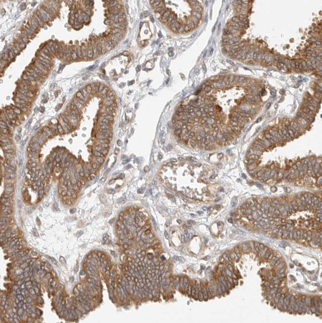 CCPG1 Antibody in Immunohistochemistry (Paraffin) (IHC (P))