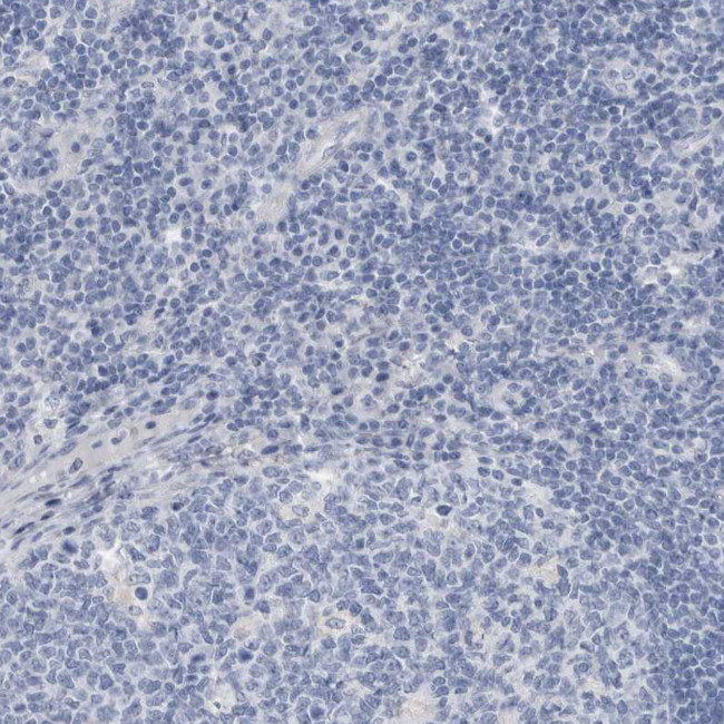 ABHD12 Antibody in Immunohistochemistry (Paraffin) (IHC (P))