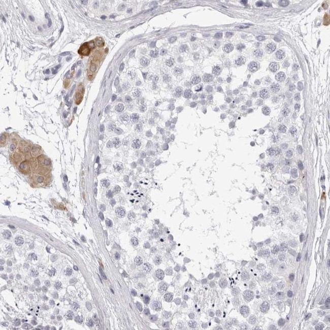 SMIM2 Antibody in Immunohistochemistry (Paraffin) (IHC (P))