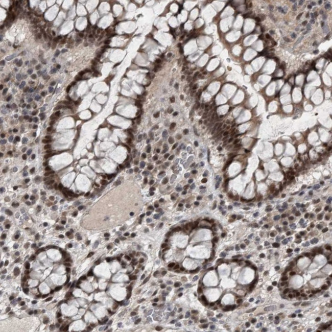 WDR33 Antibody in Immunohistochemistry (Paraffin) (IHC (P))