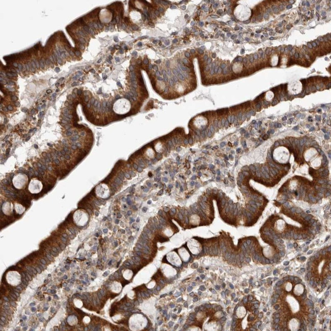 C4orf3 Antibody in Immunohistochemistry (Paraffin) (IHC (P))