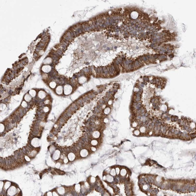 TMPRSS11F Antibody in Immunohistochemistry (Paraffin) (IHC (P))
