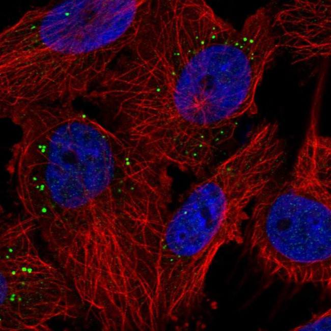 PIGP Antibody in Immunocytochemistry (ICC/IF)