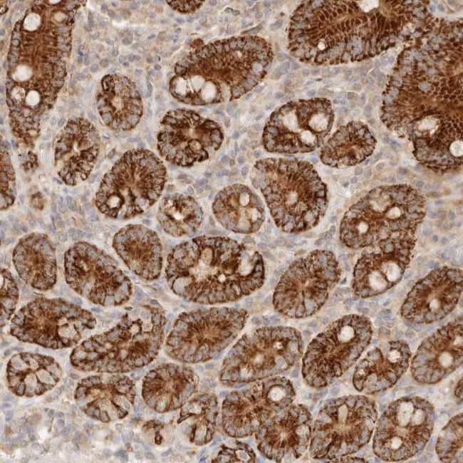 TMTC2 Antibody in Immunohistochemistry (Paraffin) (IHC (P))