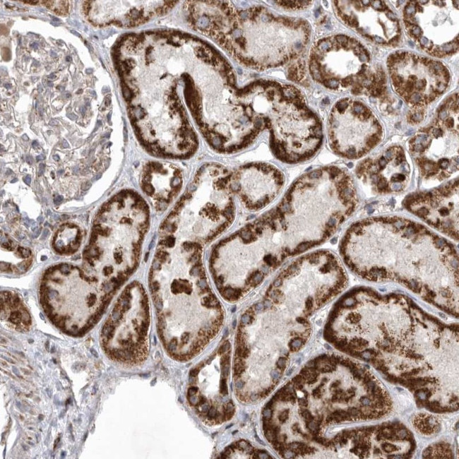 MPZL1 Antibody in Immunohistochemistry (Paraffin) (IHC (P))