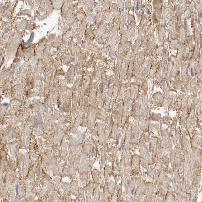 SGCD Antibody in Immunohistochemistry (Paraffin) (IHC (P))