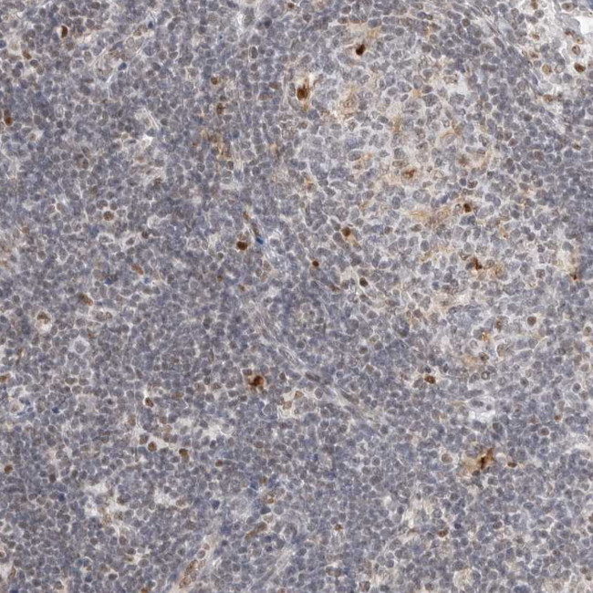 C1orf162 Antibody in Immunohistochemistry (Paraffin) (IHC (P))