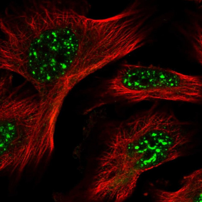 POMP Antibody in Immunocytochemistry (ICC/IF)